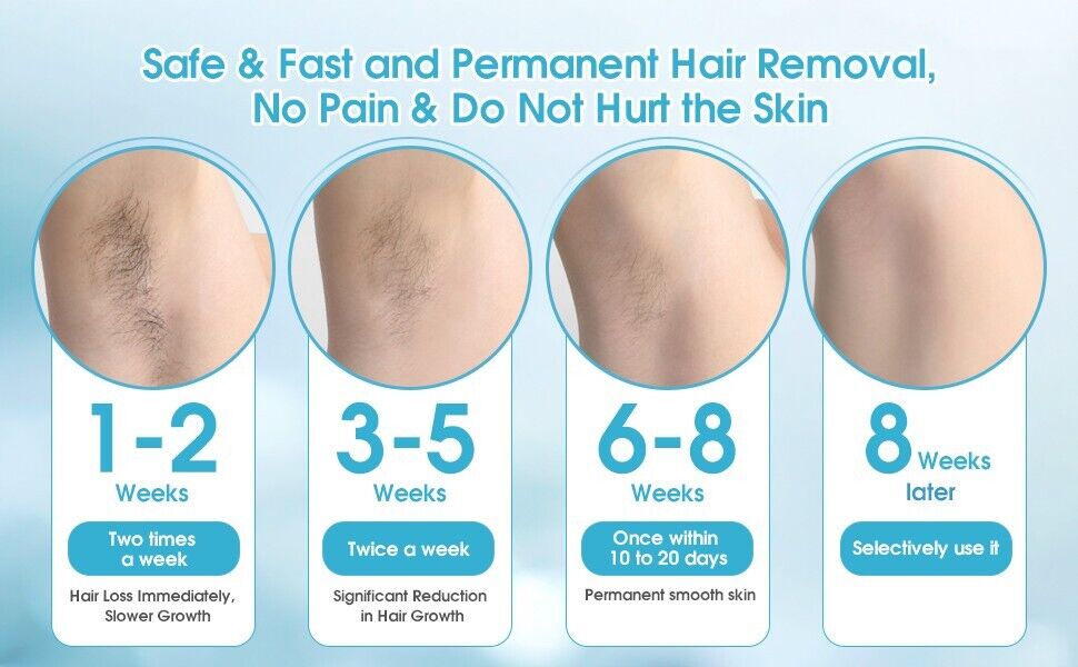 Hair Removal At-Home IPL Hair Removal for Women and Men Permanent